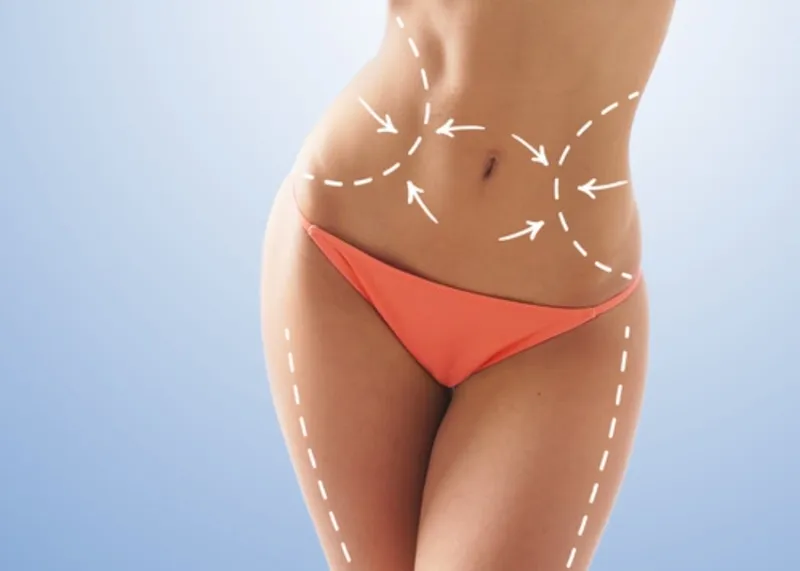 Body Aesthetics
