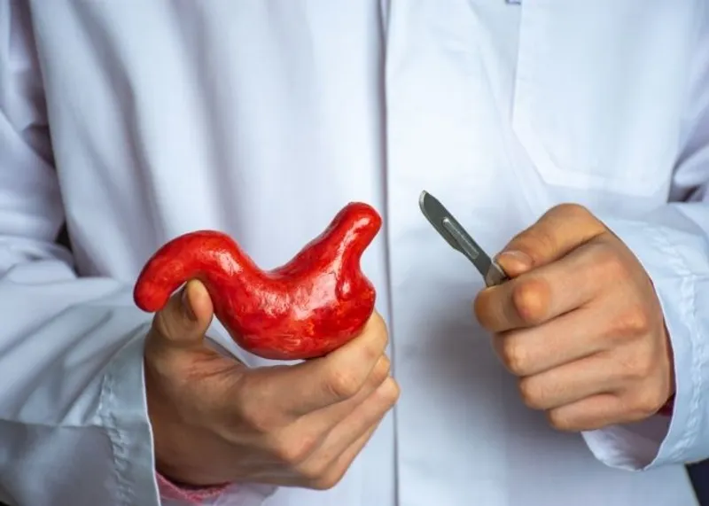 Revisional Bariatric Surgery