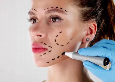 Aesthetic Plastic Surgery