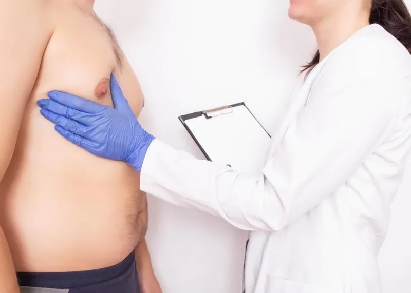 A plastic surgeon consults a male patient about breast reduction surgery for gynecomastia.