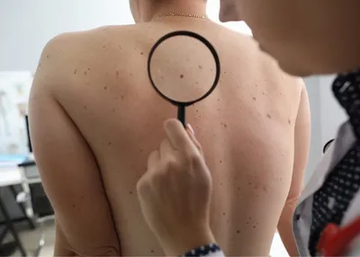 Dermatology in Istanbul: Treatments and Clinics Guide