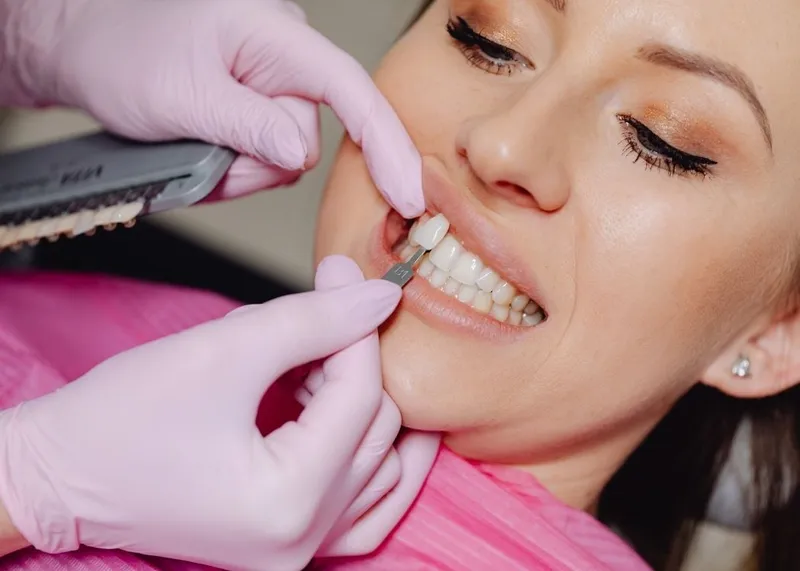 Veneer shade being matched to a patient's teeth during a dental consultation in Istanbul.