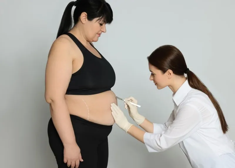 Surgeon consulting a patient about tummy tuck and liposuction options during mommy makeover planning.