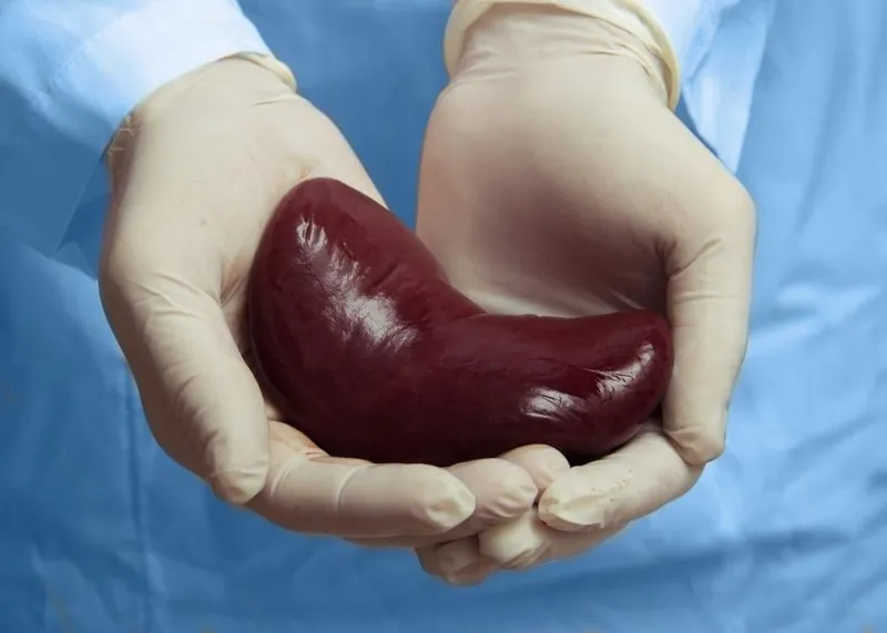 Medical team preparing a donated organ for a transplant procedure at a hospital transplant unit in Istanbul.